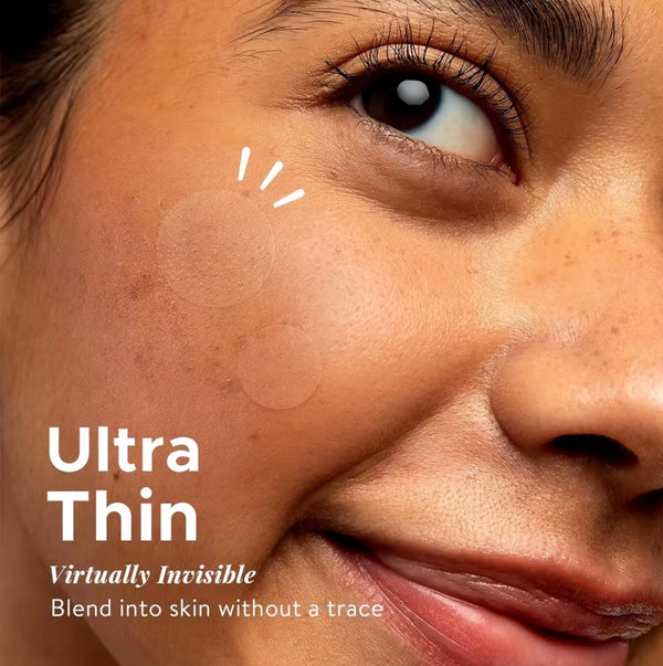 Clear Acne Solution Patches